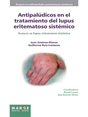 cover image of Antipalúdicos en el tratamiento del lupus eritematoso sistémico